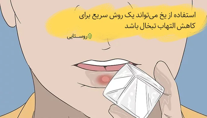 کاهش التهاب تبخال با یخ