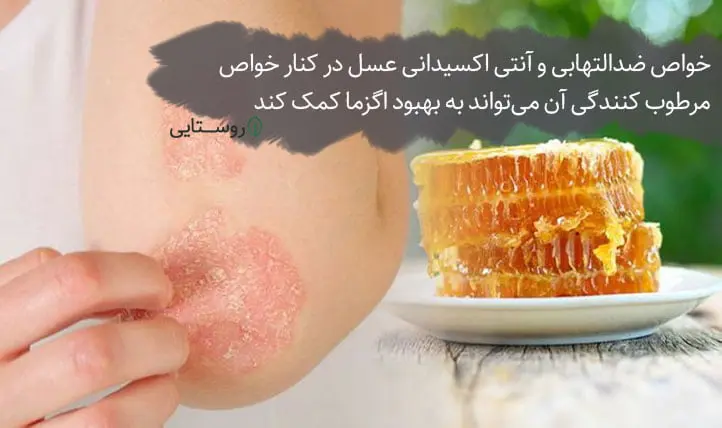 خواص ضد التهابی عسل برای اگزما