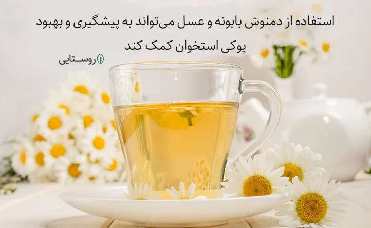 خواص بابونه و عسل برای پوکی استخوان