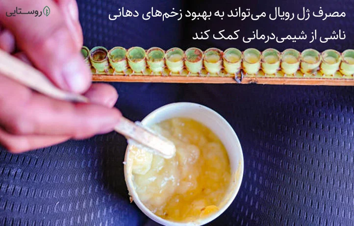 خواص ژل رویال برای عوارض شیمی درمانی