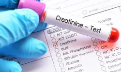 کراتین بالا